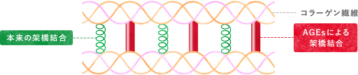 AGEsの蓄積によって弾力性が低下した状態